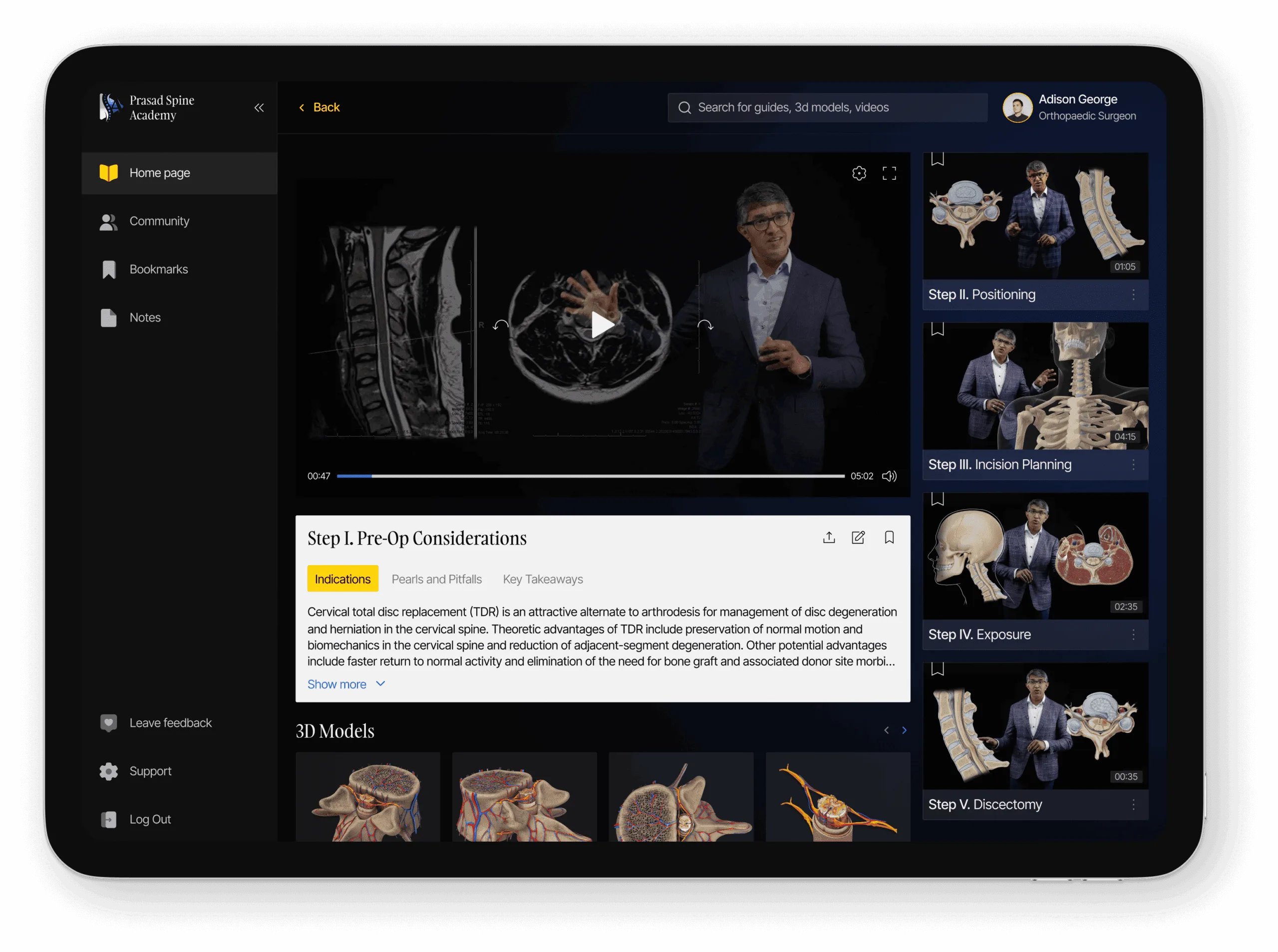 Step-by-step guides on iPad