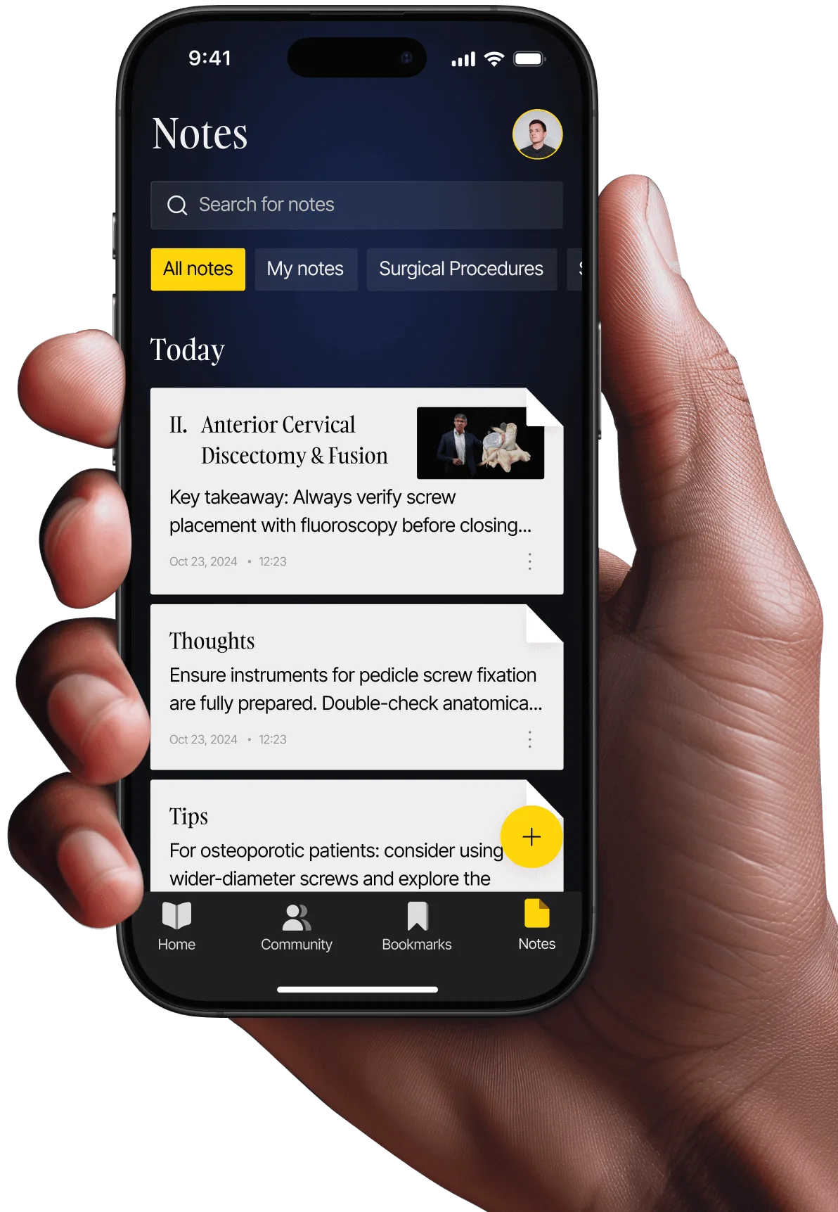 Notes Feature